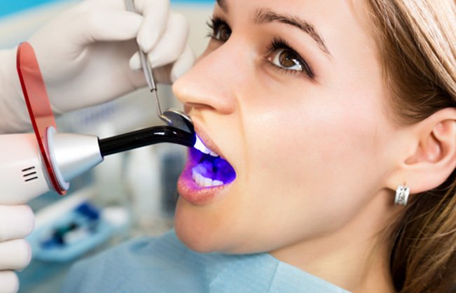 Patient in Sumner talking to getting cosmetic dental bonding