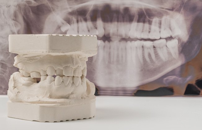 Examples of dentures in Sumner 