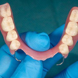 Example of partial dentures in Sumner