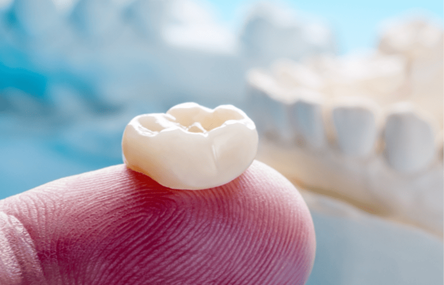 broken tooth repair