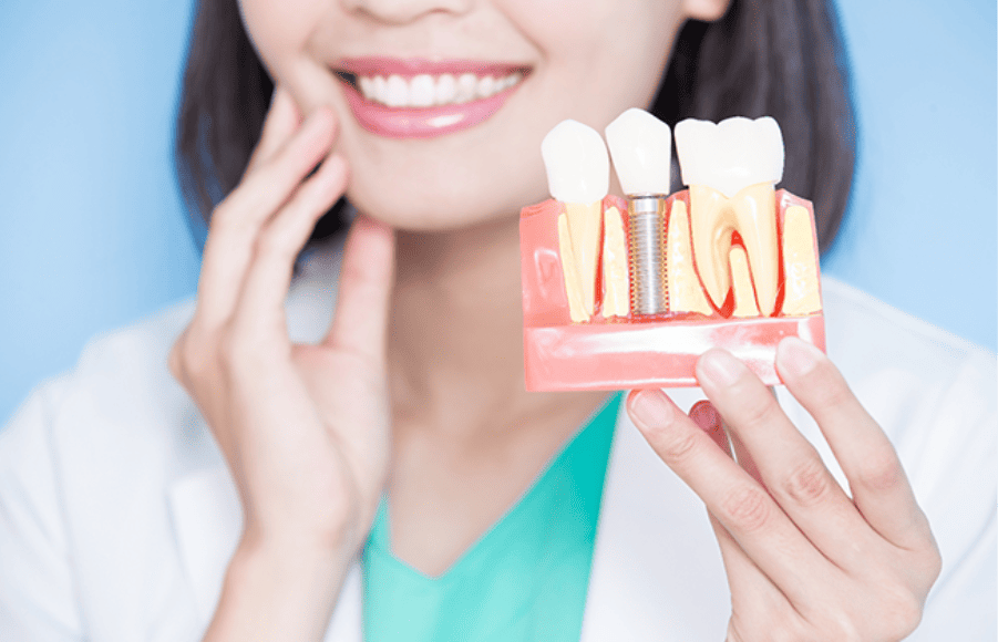 full dental implants
